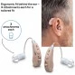Beurer Rechargeable Hearing Amplifier HA55 (Pair)