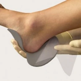 Mepilex Heel Ag Dressing (13cm x 20cm)